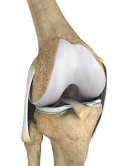 Multiligament Instability